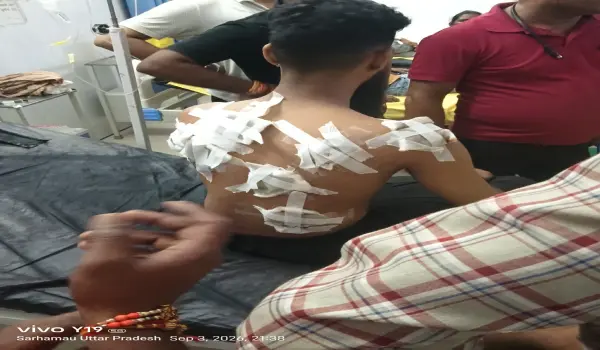 लखनऊ के बीकेटी में कॉलेज छात्रों के बीच मारपीट, एक घायल